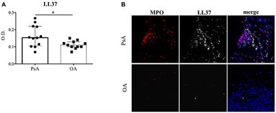 Anti-LL37 Antibodies Are Present in Psoriatic Arthritis (PsA) Patients: New Biomarkers in PsA